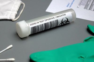 Полный перечень диагностических тестов для выявления коронавируса в России на 18 августа