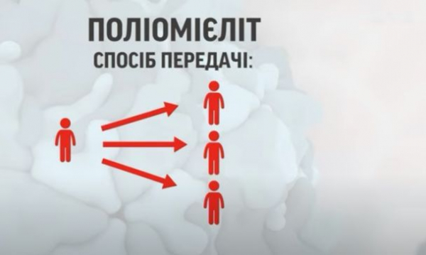 Полиомиелит возвращается: что нужно знать о вирусе и как не заразиться