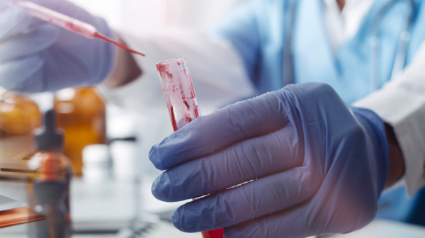 FDA одобрило первый препарат на основе сухого концентрата плазмы крови